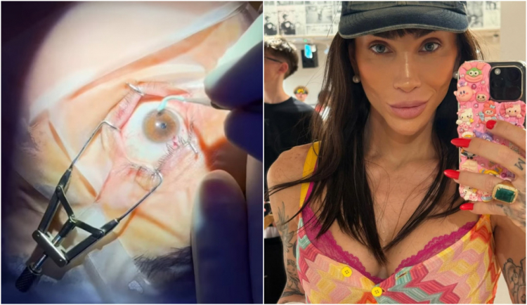 Mudar a cor dos olhos como Maya Massafera  sonho esttico ou risco  viso?